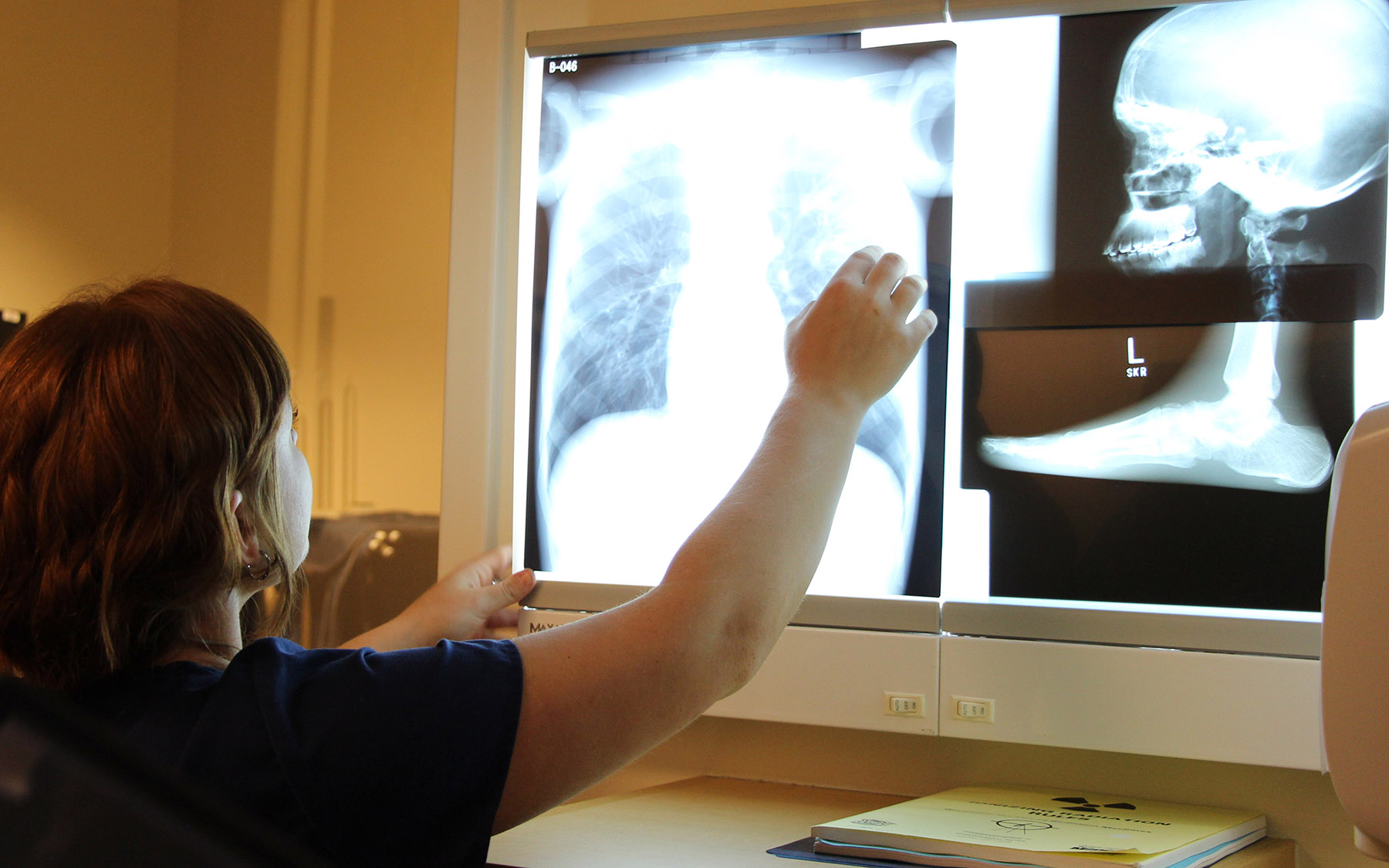 Student examining x-rays.