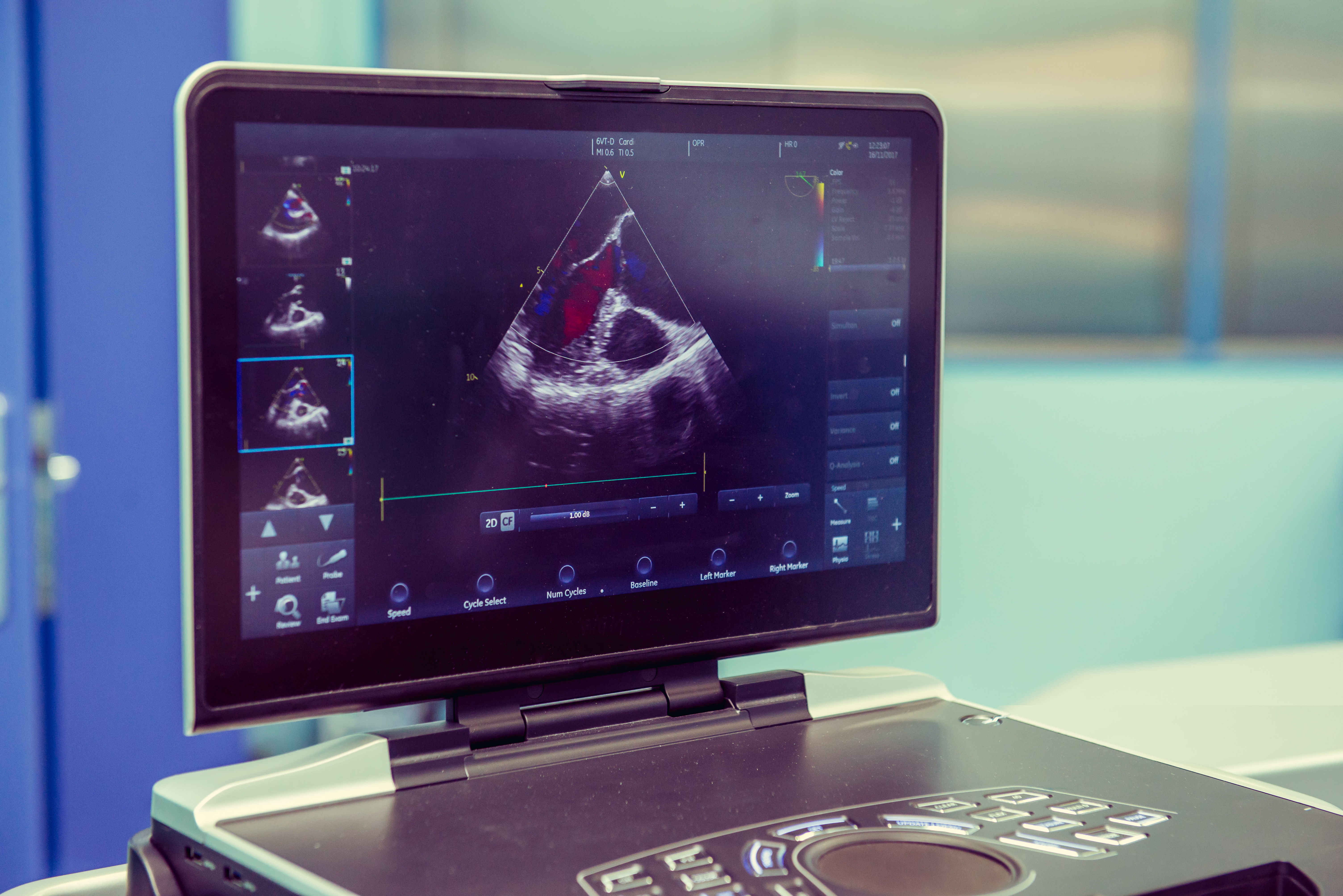The visual display of a cardiac sonography read out during an examination.
