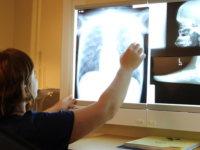 Student examining x-rays.