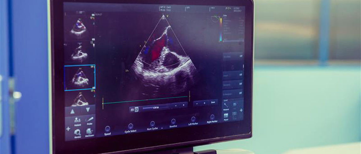 A medical monitor displays a heart ultrasound (echocardiogram) with a grayscale image of the heart and colored Doppler flow indicating blood movement. The screen includes smaller preview images on the left and control settings along the bottom and right side, suggesting the scan is being actively analyzed in a clinical setting.