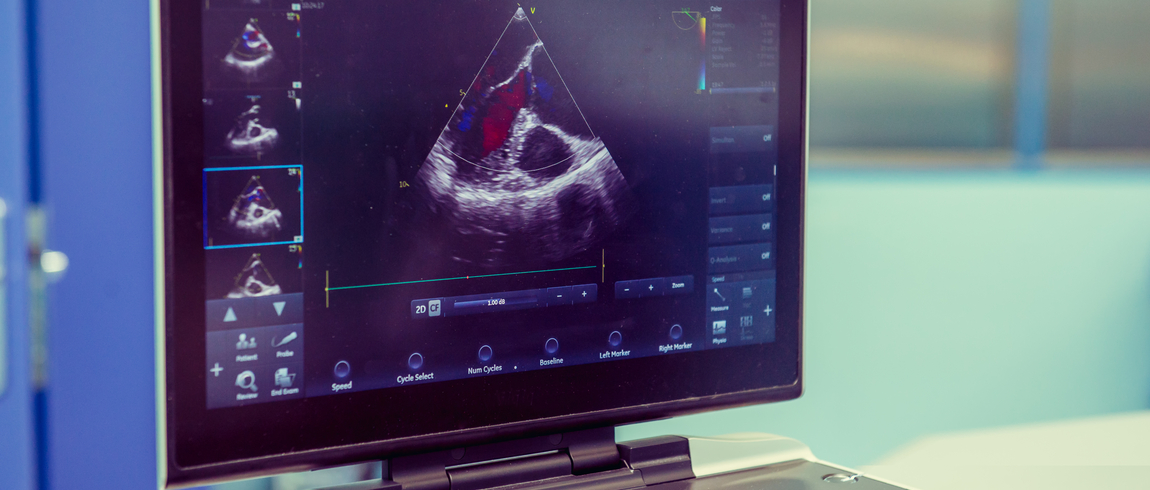 Heart Ultrasound