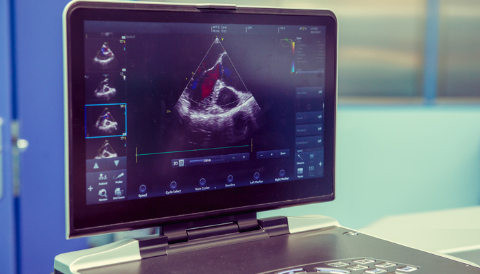 The visual display of a cardiac sonography read out during an examination.