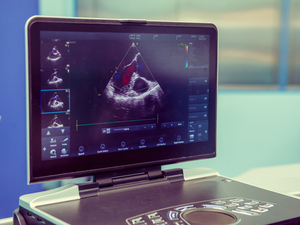 Heart Ultrasound